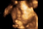 Sonar stills
